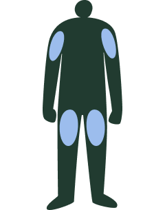 Illustration of human diagram of areas to administrate naloxone.